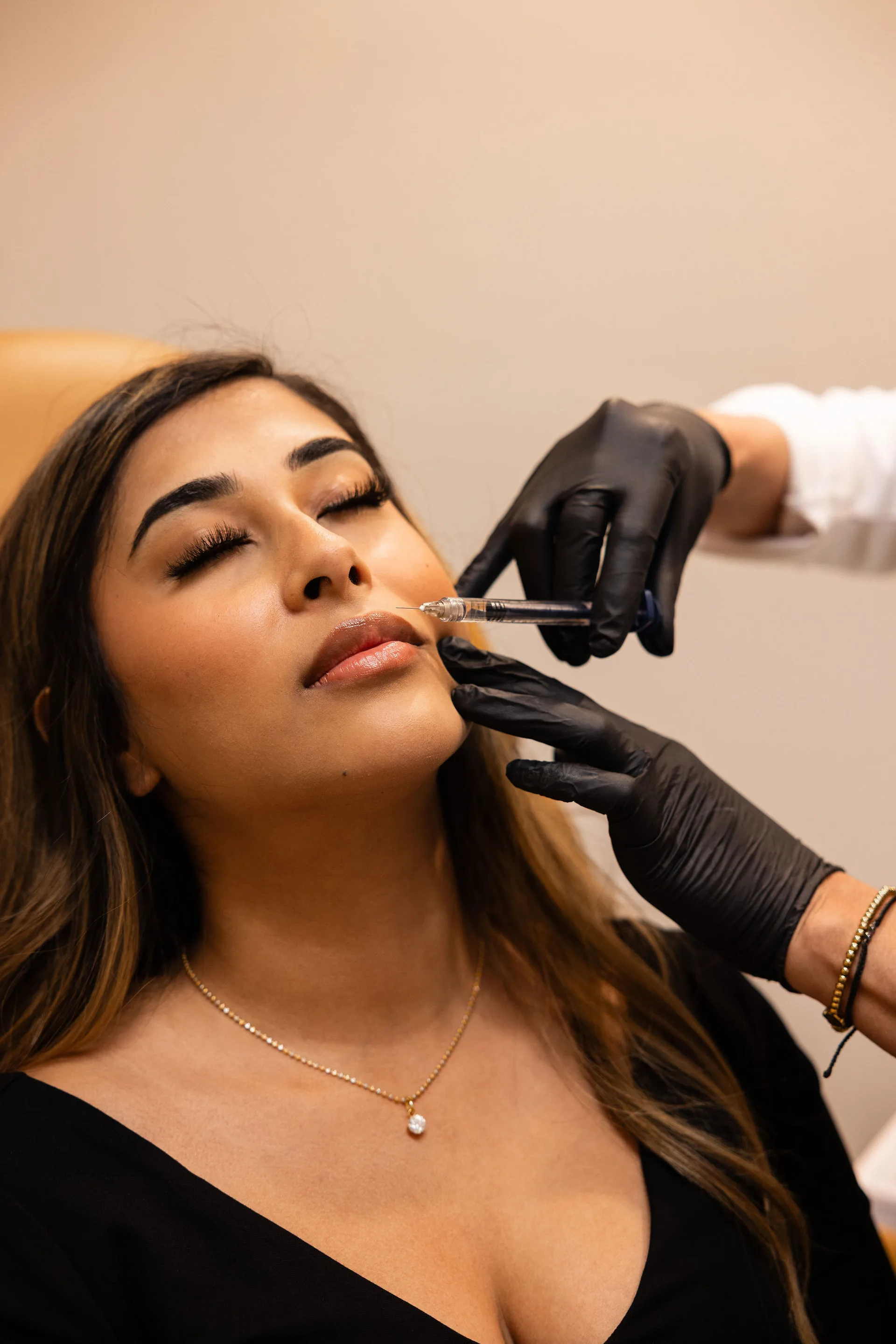 Dermal Fillers at Younger You Aesthetics — Northern California