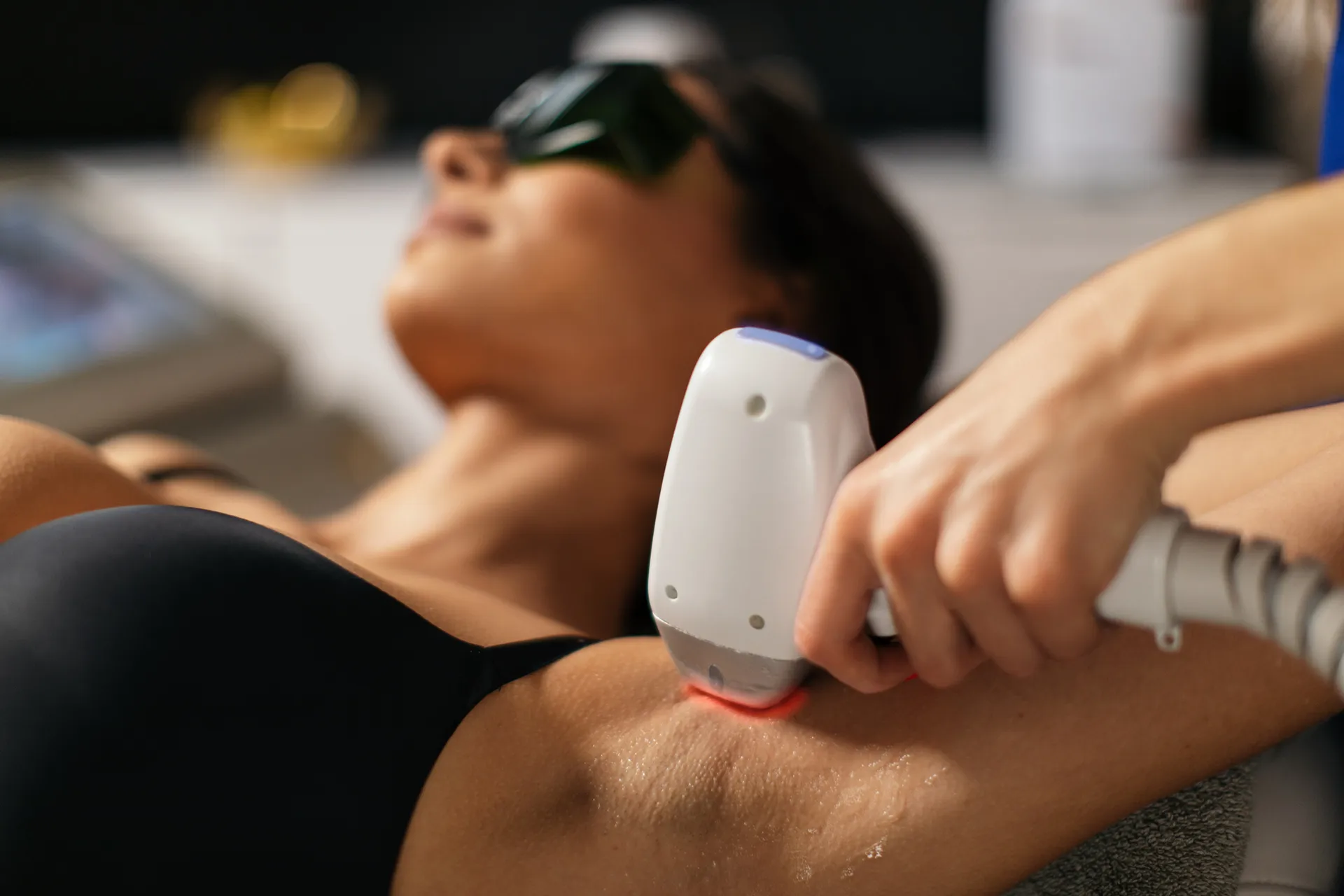 Laser Hair Removal — overview