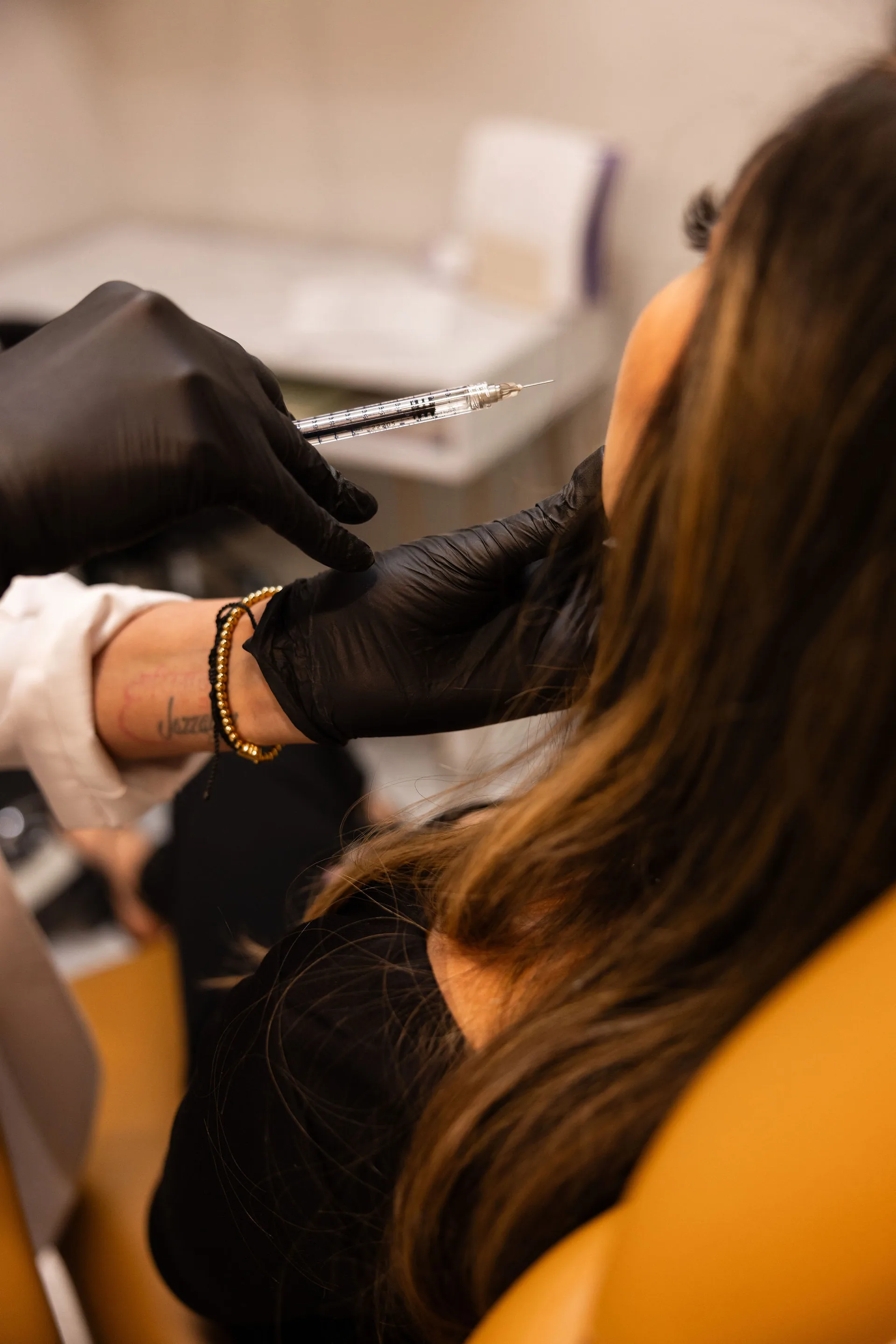 Sculptra at Younger You Aesthetics — Northern California